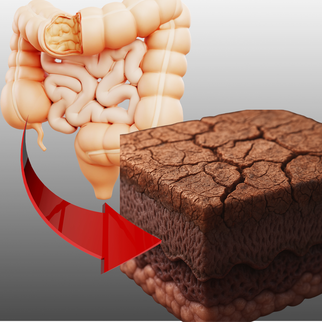 肌の老化は「腸」から始まる！？