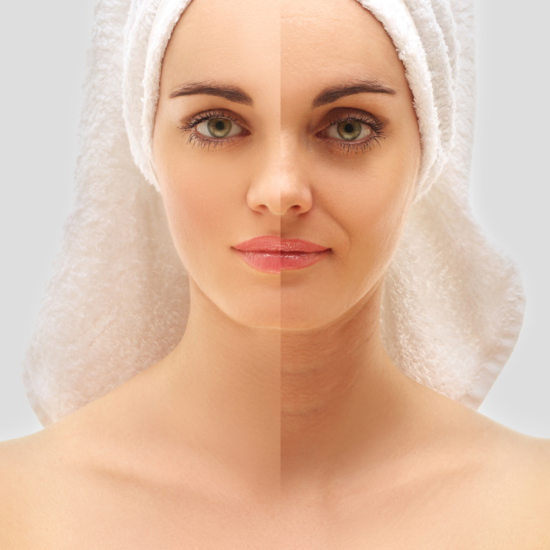 隠れた老化の真犯人！？あなたの肌を「焦がす」糖化、今日から防ぐ徹底対策